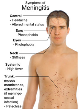 Infections of the spine - symptoms, causes, diagnosis, and treatment from the spine specialists at KBNI.