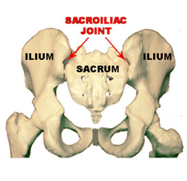 Sacroiliac Joint Pain is A Cause of Low Back Pain