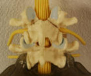 Spinal lamina intact